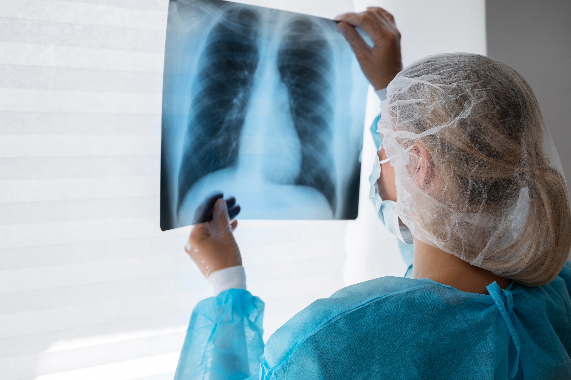 X-ray Preview